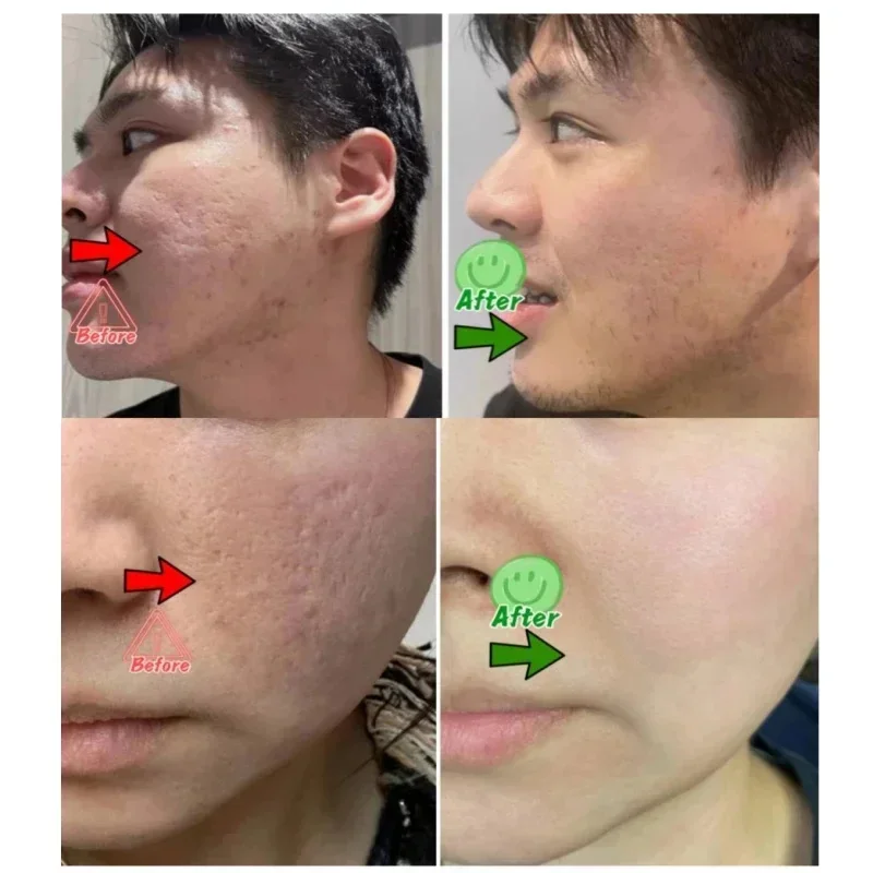 Salicylic Acid Pore Clearing C - Korean Skincare Routine reseña y precio