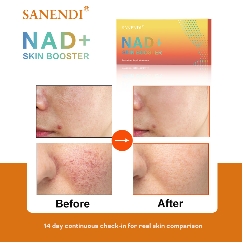 Sanendi NAD+ Korea Skincare Pr - Korean Skincare Routine reseña y precio