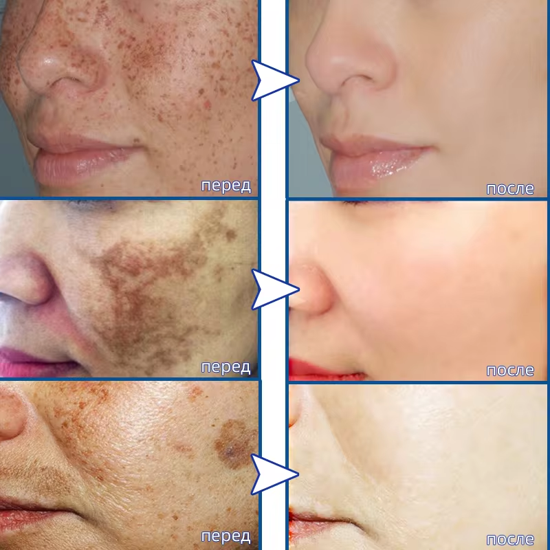 Powerful Spot-removing Whiteni - Korean Skincare Routine reseña y precio