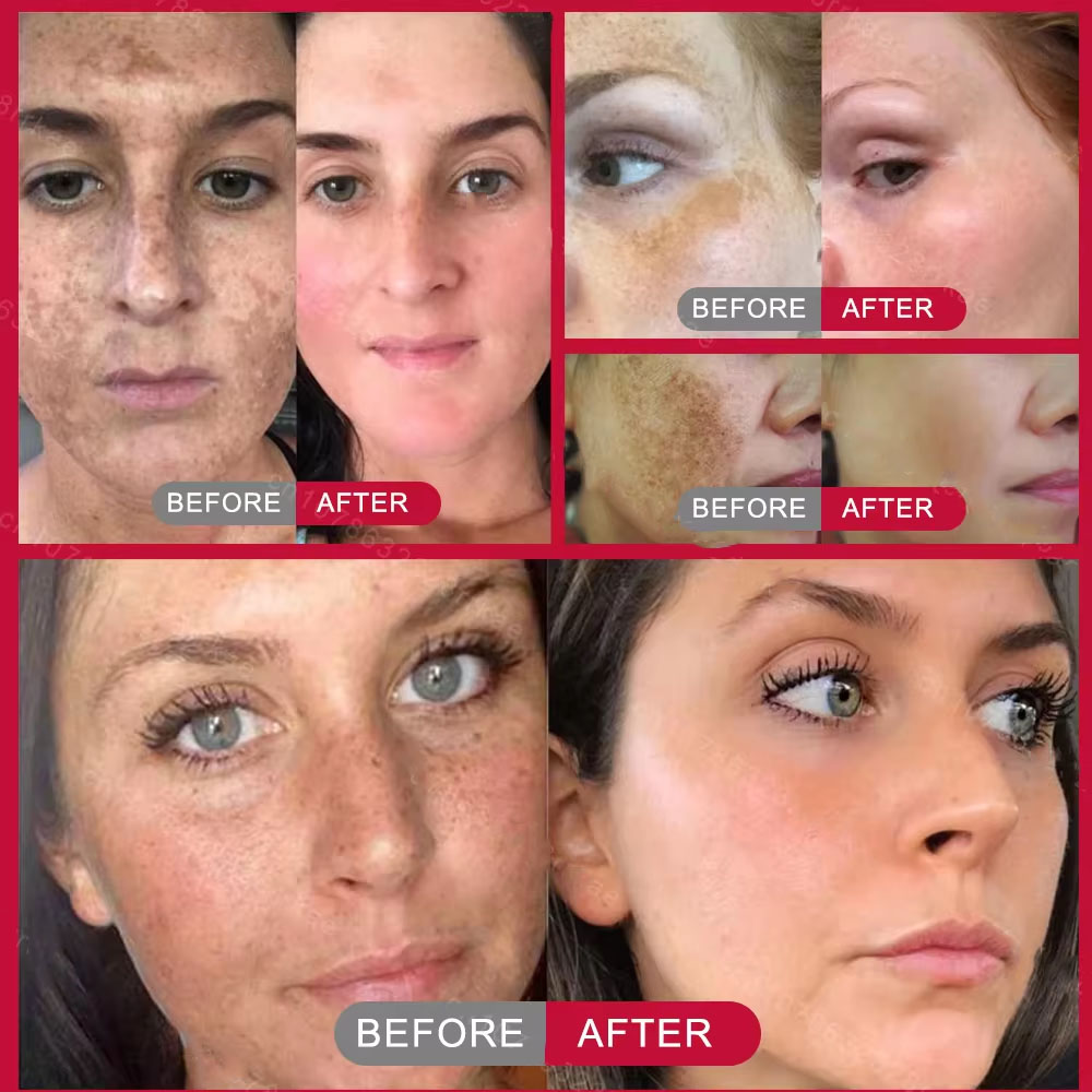 Powerful Spot-removing Whiteni - Korean Skincare Routine reseña y precio