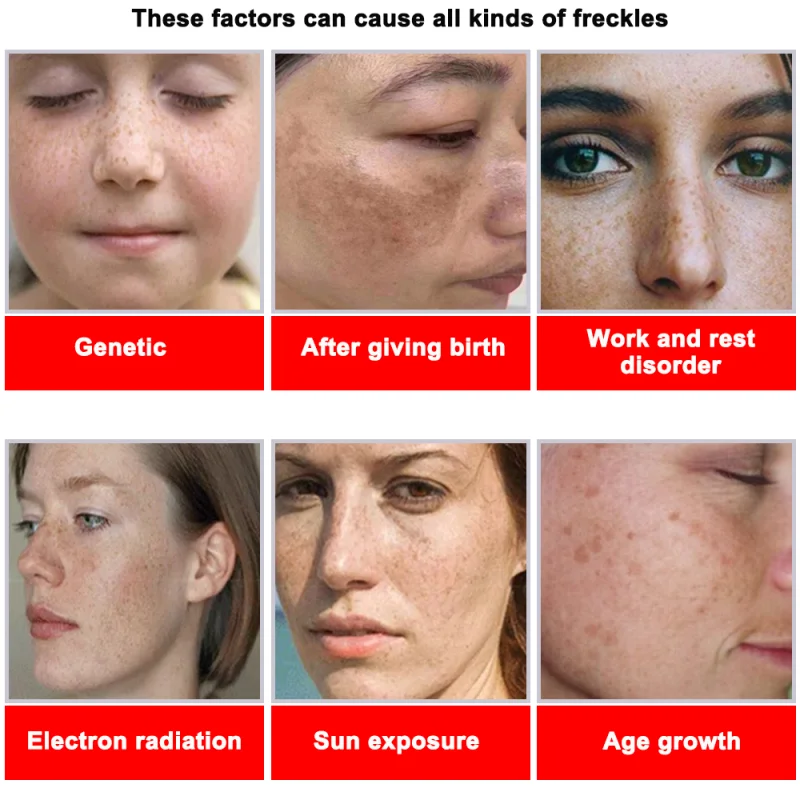Powerful Spot-removing Whiteni - Korean Skincare Routine reseña y precio