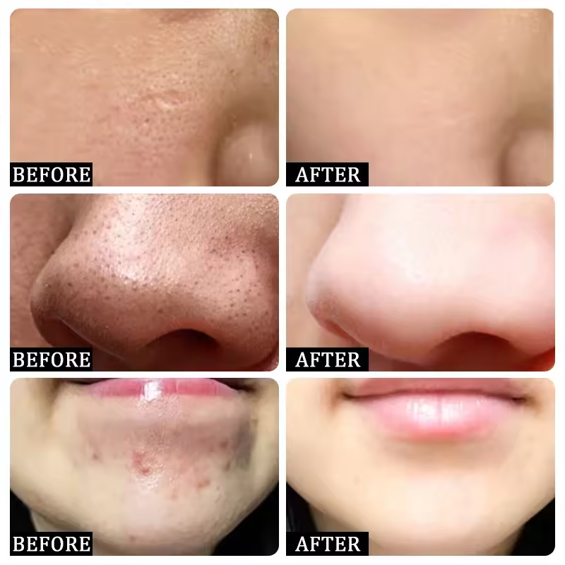 Pore Shrinking Cream Eliminati - Korean Skincare Routine reseña y precio