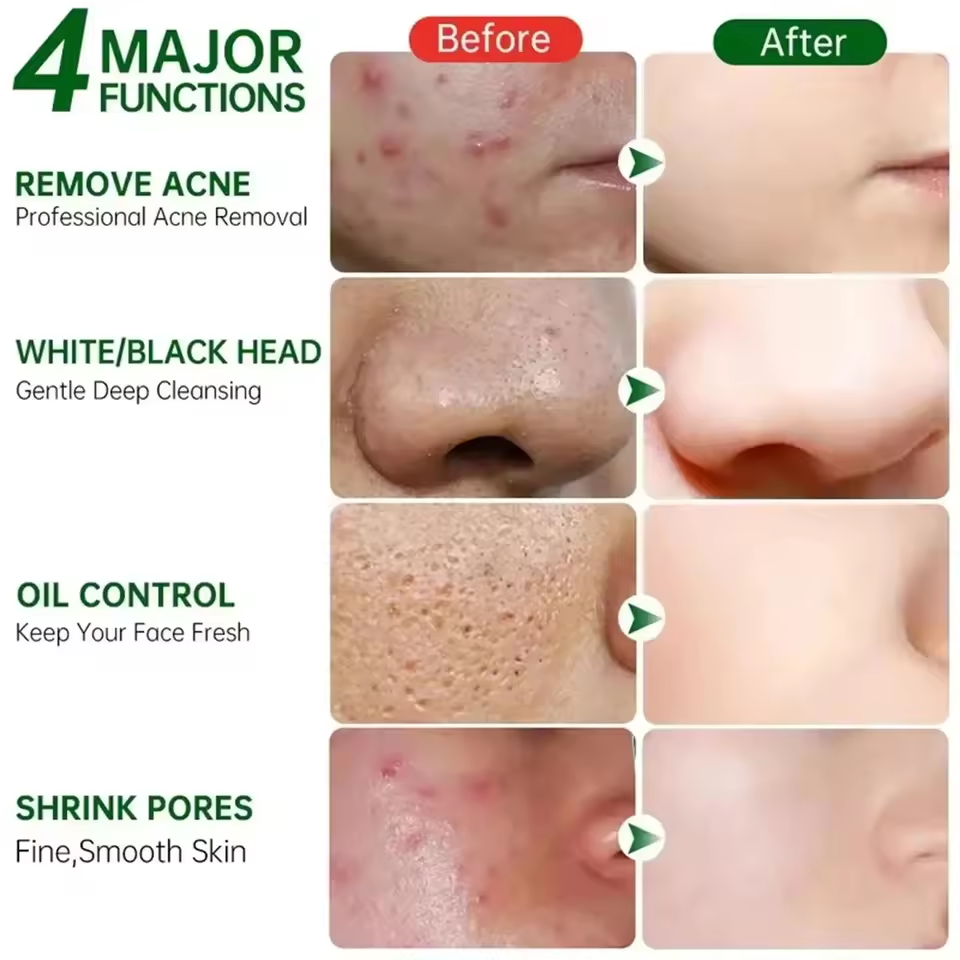 Pore Shrinking Cream Eliminati - Korean Skincare Routine reseña y precio